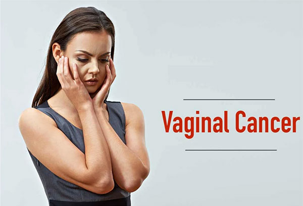 Vaginal-Cancer